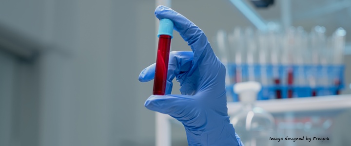 Imperial College London seeks a Non-Clinical Lecturer or Senior Lecturer in Multiple Myeloma Biology